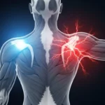 근육통과 근막통의 감별진단과 대처법